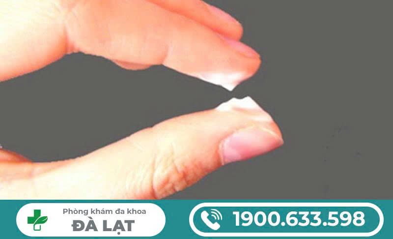 Hình ảnh minh họa